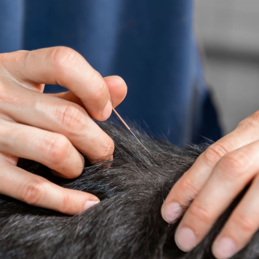 Acupuncture, Rancho Palos Verdes